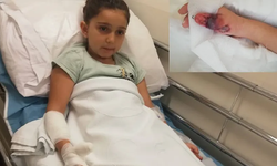 MR çekilen kızın parmakları ve kolu yandı